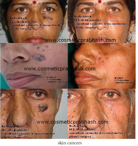 Face Plastic & Cosmetic surgery, Delhi, India