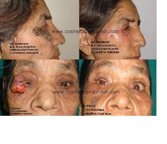 Face Plastic & Cosmetic surgery, Delhi, India